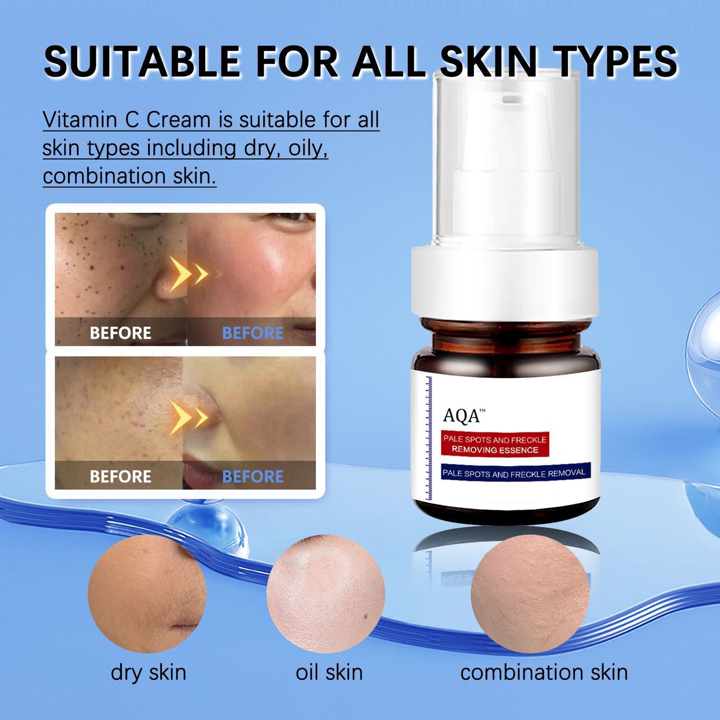 🔥AQA™Vitamin C Whitening Freckles Face Cream Remove Melasma Dark Spots Lighten Melanin